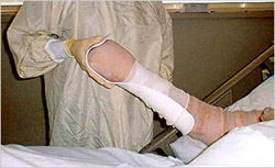 Paddle splint