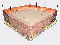 DAY 7-14: NEW DERMIS FORMATION