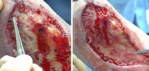 Process of inspecting and preparing Neodermis 